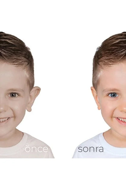 Kepçe Kulak Düzeltici ve Önleyici Bant  Kozmetik Bandı 1 Alana 1 Bedava