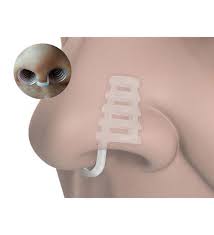 1 Alana 1 Bedava Horlama Önleyici Burun Aparatı